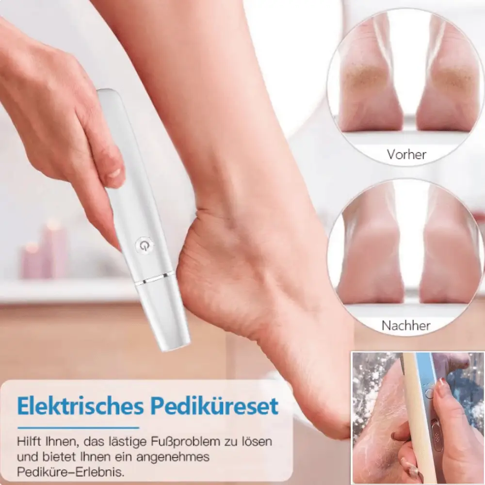 💥 Hot Sale 60% Rabatt💥Elektrischer Hornhautentferner für die Füße👣
