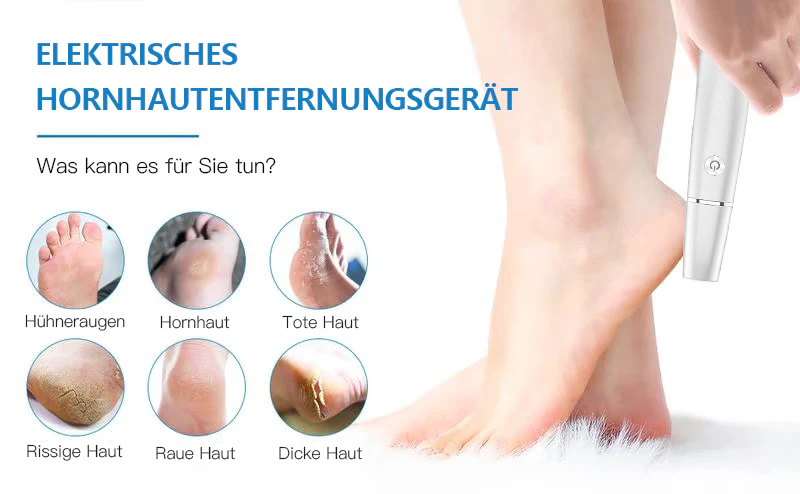 💥 Hot Sale 60% Rabatt💥Elektrischer Hornhautentferner für die Füße👣 - Image 11