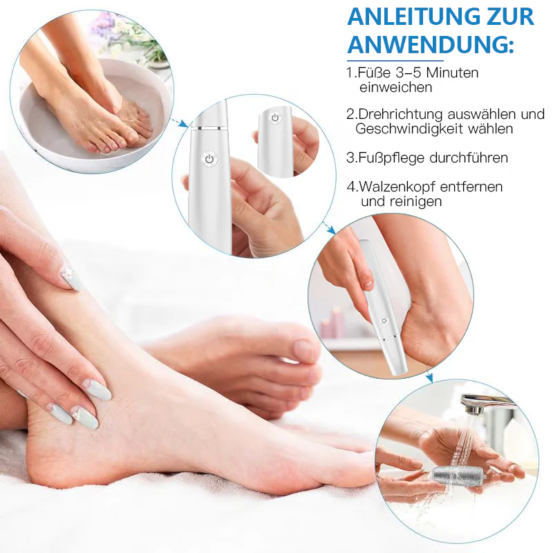💥 Hot Sale 60% Rabatt💥Elektrischer Hornhautentferner für die Füße👣 - Image 3